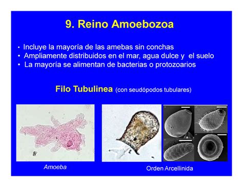  Globochaete! Descubriendo un Amoebozoa con la capacidad de cambiar de forma y una dieta de bacterias hambrienta