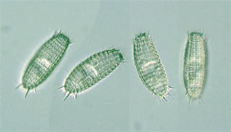  Coleps! Un Viajero Microscópico con Cilia que Te Dejará Asombrado