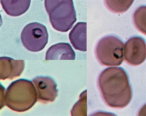  Plasmodium: Un Pequeño Parásito Que Hace Temblar al Mundo! 